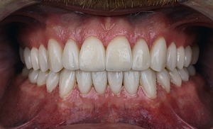 Teeth close up