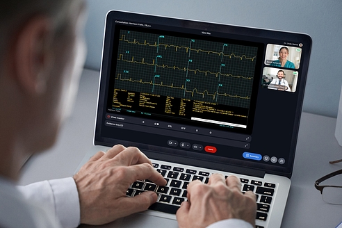 ECG Telecardiology