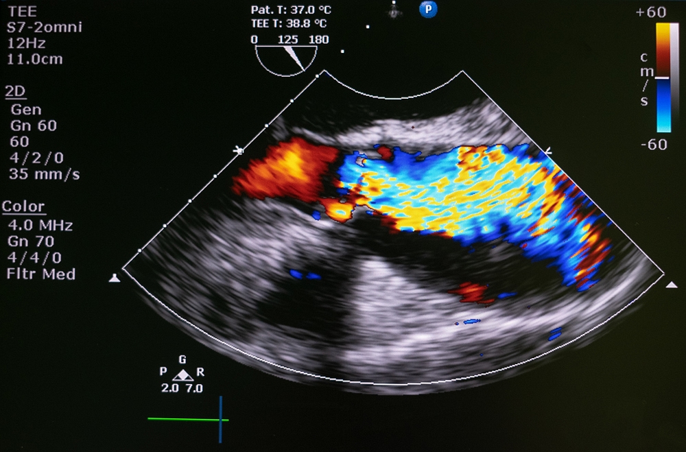 Medical Imaging Market Size 2026
