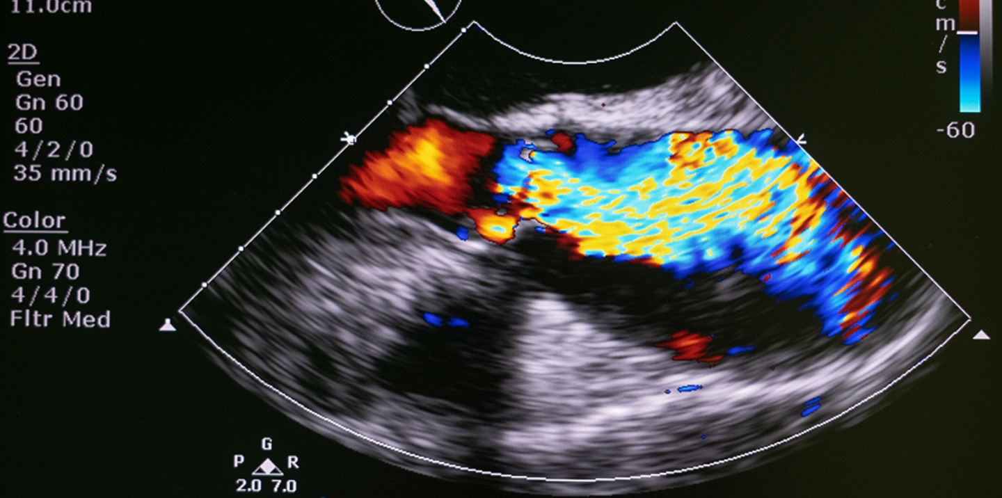 Medical Imaging Market Size 2026