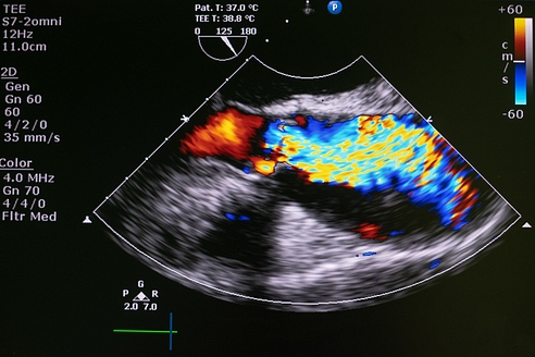 Medical Imaging Market Size 2026