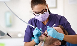 Dental cleaning