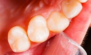 Dental imaging